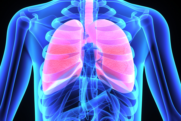 x-ray of a person's lungs